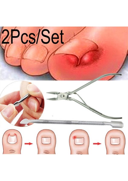 Profesyonel Yeni Batık Ayak Tırnak Makası Düzeltme 2 Pc Tırnak Pense Kesiciler Ölü Cilt Kir Sökücü Pedikür Bakım Aracı (Yurt Dışından)