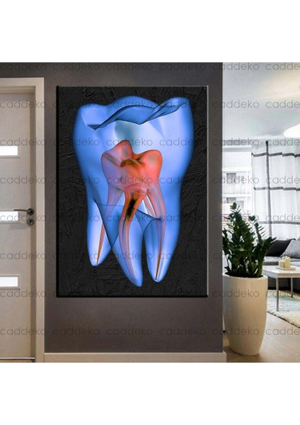 Ağız ve Diş Sağlığı Polikliniği Tabloları Dekoratif Diş, Dekoratif Dişçi, Dişçi Dekorasyonu DSC-135