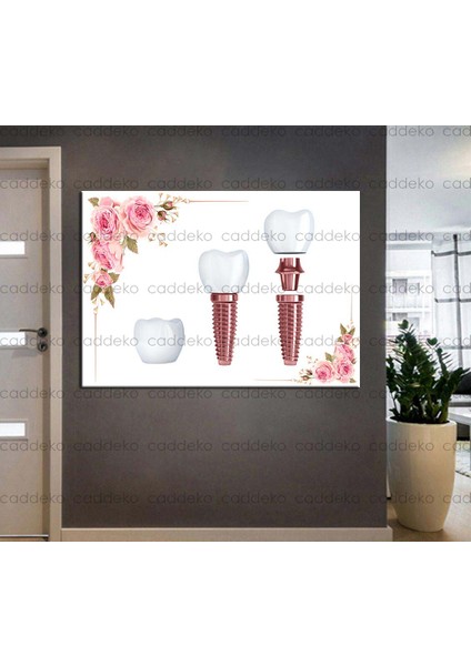 Ağız ve Diş Sağlığı Polikliniği Tabloları Dekoratif Diş, Dekoratif Dişçi, Dişçi Dekorasyonu DSC-168