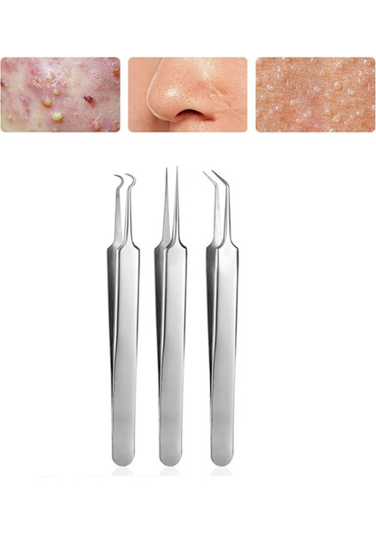 3 Adet/Takım Komedon Yüz Cilt Bakımı Aracı Iğneler Yüz Temizleyici (Yurt Dışından) indirimleri