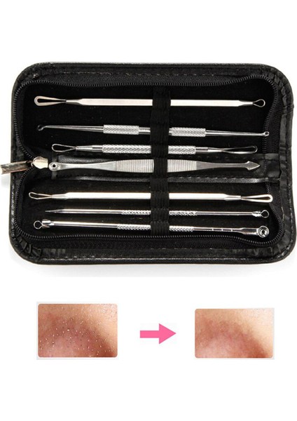 7 Adet Paslanmaz Çelik Komedon Temizleme Iğnesi Güzellik Aracı (Yurt Dışından)