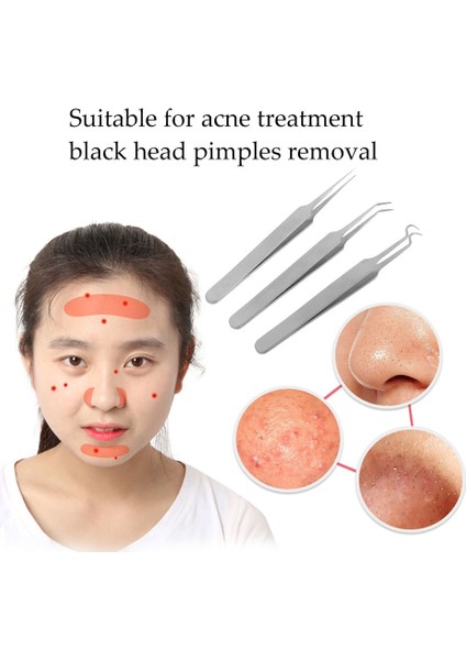 Cilt Temizleme Komedon (Yurt Dışından) fiyatları