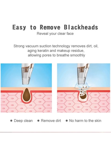 Elektrikli Iğneler Vakum Temizleme Makinesi Peeling (Yurt Dışından) fırsatları