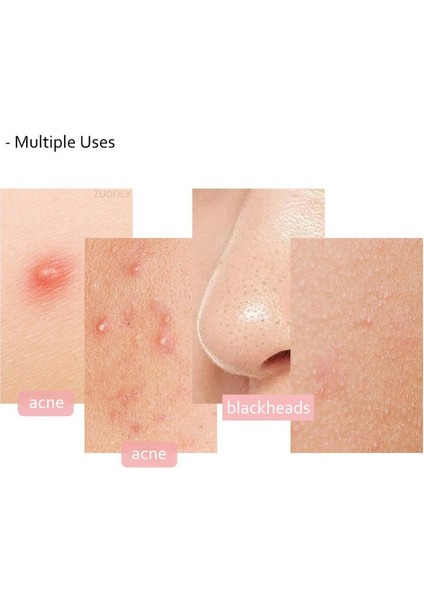 Ultra-Ince No. 5 Klip Cımbız Güzellik Salonu Iğne Aracı (Yurt Dışından) fırsatları