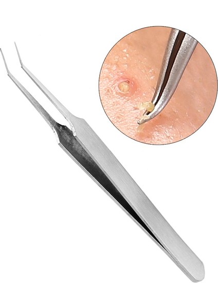 Cilt Temizleme Komedon (Yurt Dışından) indirimleri