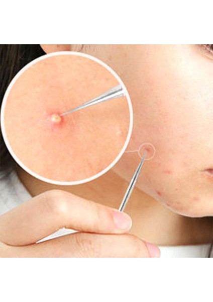 7 Adet Komedon Yüz Cilt Bakımı Aracı Iğneler Yüz Temizleyici (Yurt Dışından) fiyatları