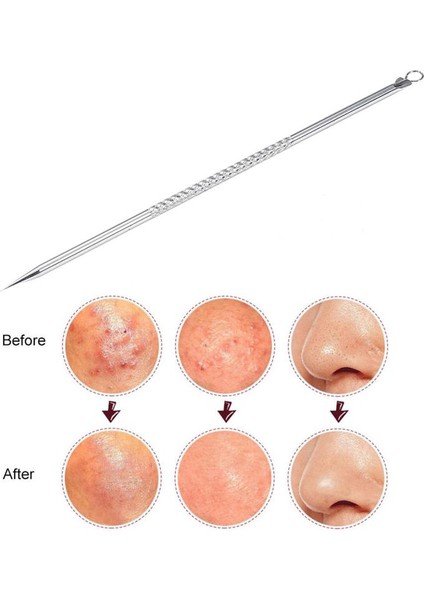 1 Adet Gümüş Iğne Cilt Bakım Araçları (Yurt Dışından) fırsatları