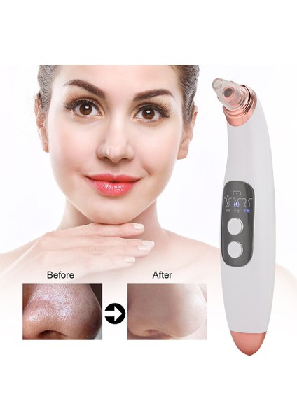 Elektrikli Yüz Temizleyici (Tip 1) (Yurt Dışından) indirimleri