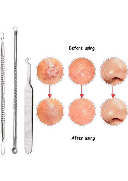 Cilt Temizleme Iğnesi Komedon Yüz Bakımı Araçları (Yurt Dışından) fiyatları