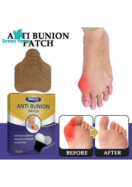 Yeşil Ev Ayak Başparmak Çıkartması Ince Işçilik Düzeltici Ayak Bakım Yaması (Yurt Dışından) fırsatları