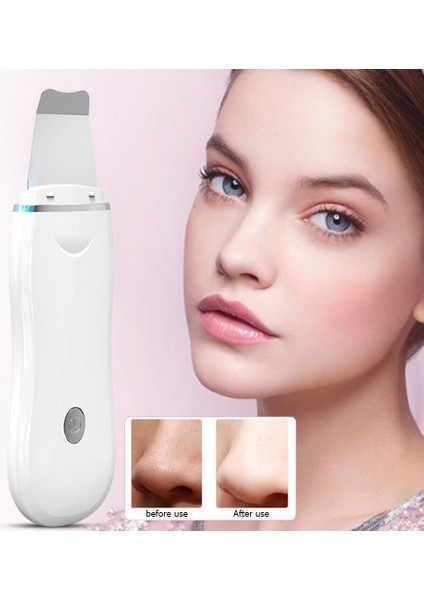 Ultrasonik Cilt Temizleyici (Yurt Dışından) modelleri