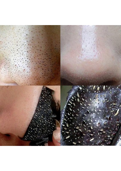 50 Adet Yüz Temizleme Şeridi (Yurt Dışından) fiyatları