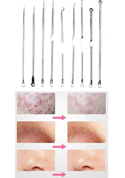 9 Adet Yüz Iğneler Komedon Temizleme Kiti Çift Kafa Yüz Bakımı Aracı (Yurt Dışından) modelleri