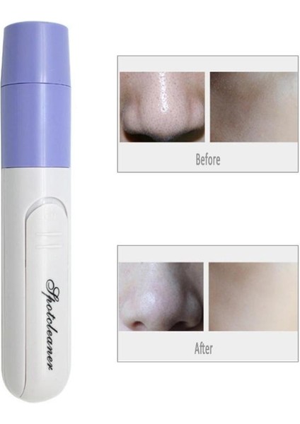 Sıcak Taşınabilir Yüz Temizleyici Güzellik Makinesi (Yurt Dışından) fiyatları