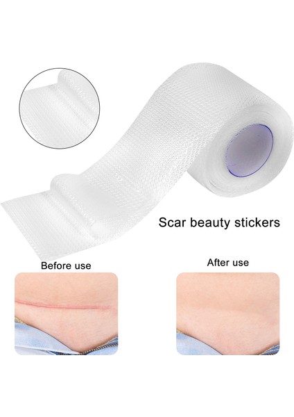 Cilt Bandı (Yurt Dışından) indirimleri