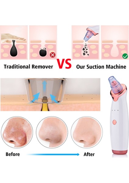 Cilt Temizleyici Vakum Elektrikli Burun Güzellik Yüz Cilt Bakımı E Tooltype1 (Type1) (Yurt Dışından) indirimleri