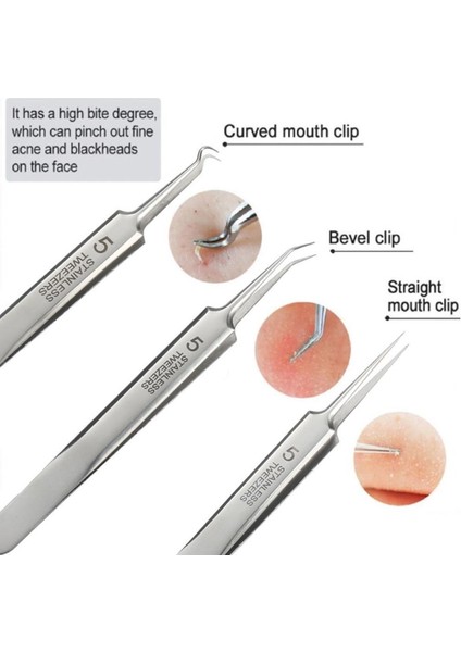 Ultra-Ince No. 5 Komedon Klip Yüz Cilt Bakımı Iğneler(Yurt Dışından)