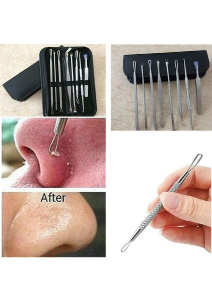 7/8 Adet Paslanmaz Çelik Komedon Yüz Alet Kiti Çanta İle 7 Adet (Çanta İle 7 Adet) (Yurt Dışından) modelleri