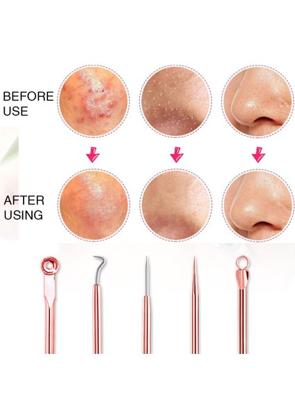 4 Parça Yüz Bakımı Temizleme Paslanmaz Çelik Iğne Aracı (Yurt Dışından) fiyatları