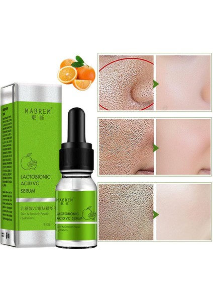 Laktoz Vc Gençleştirici Esans Doğal Cilt Besleyici Onarıcı Esans (Yurt Dışından)