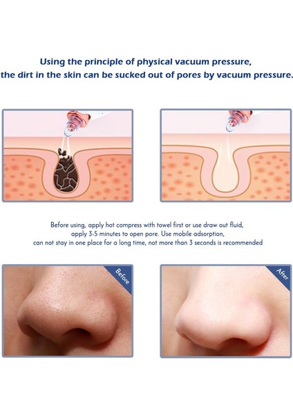Elektrikli Yüz Temizleme Nemlendirici Püskürtücü İle (Yurt Dışından) modelleri