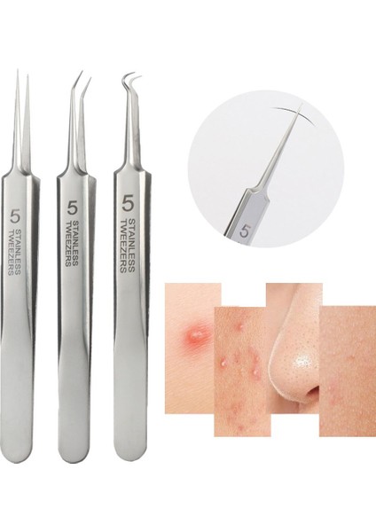 Burun Yüz Komedon (Yurt Dışından) fiyatları