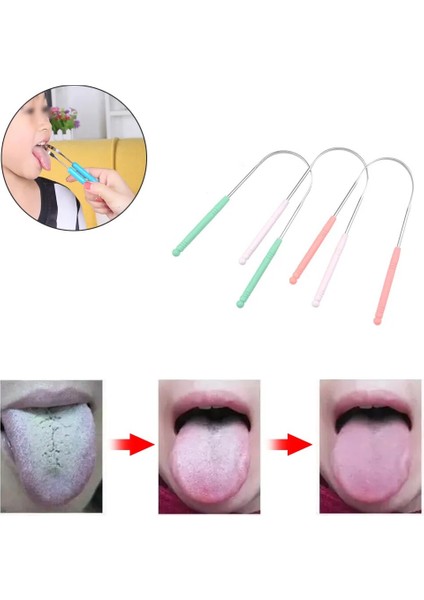 Adet Paslanmaz Çelik Kazıyıcı Dil Temizleyici Spatula Diş Fırçası Ağız Hijyeni Geğirme Değil Kötü Nefes Temizleme Taze Tutmak (Yurt Dışından) fiyatları