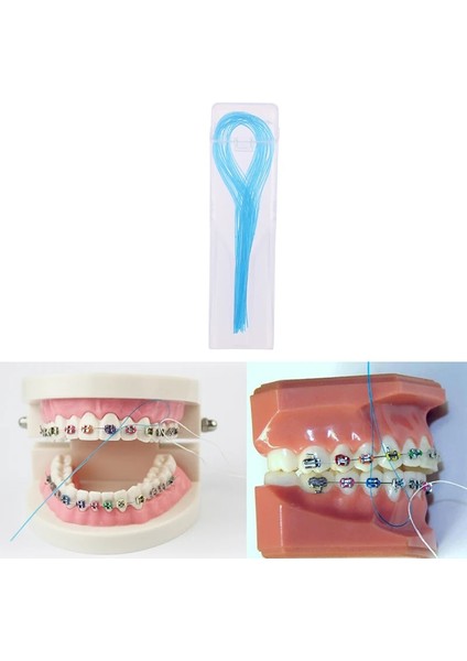 Et Diş Ipi Diş Açıcılar Ortodontik Parantezler Arasında Diş Ipi Tutucuları Köprü Diş Yeni Varış (Yurt Dışından) modelleri