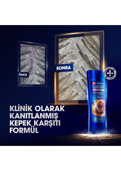 Men Kepeğe Karşı Etkili Şampuan Saç Dökülmesine Karşı 350 ml