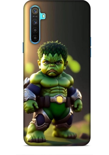 Realme 6i Kılıf Caliburn 24 Hulk Bebek Darbe Emici Kılıf