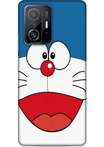 Xiaomi 11T Kılıf Caliburn 22 Mavi Beyaz Kap