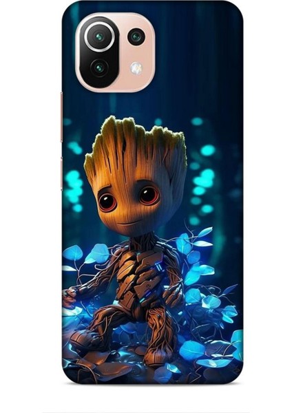 Xiaomi 11 Lite 5g Kılıf Caliburn 26 Bebek Groot Soft Kapak