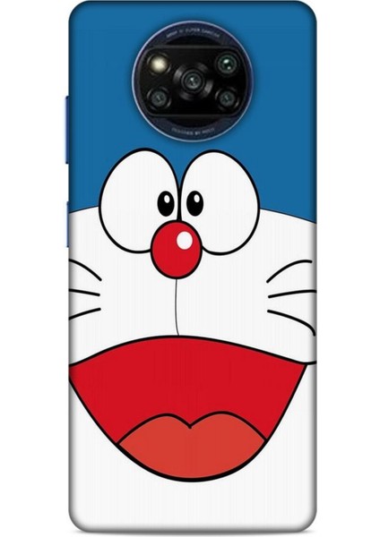 Xiaomi Poco X3 Pro Kılıf Caliburn 22 Mavi Beyaz Kap