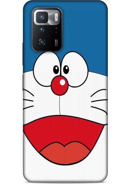 Xiaomi Poco X3 Gt Kılıf Caliburn 22 Mavi Beyaz Kap