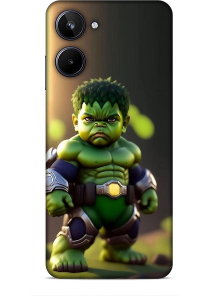 Realme 10 Kılıf Caliburn 24 Hulk Bebek Darbe Emici Kılıf