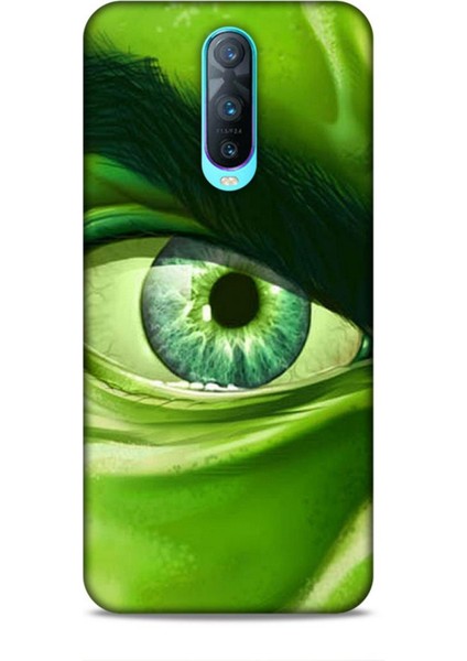 Oppo RX17 Pro Kılıf Caliburn 29 Hulk Göz Makro Leke Tutmaz Kapak