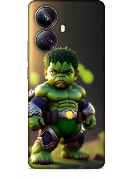 Realme 10 Pro Plus Kılıf Caliburn 24 Hulk Bebek Darbe Emici Kılıf