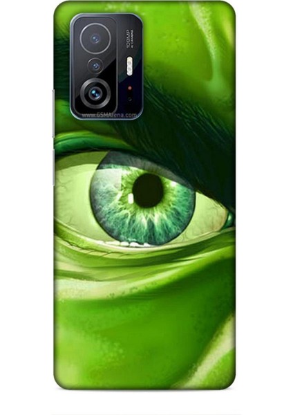 Xiaomi 11T Kılıf Caliburn 29 Hulk Göz Makro Leke Tutmaz Kapak