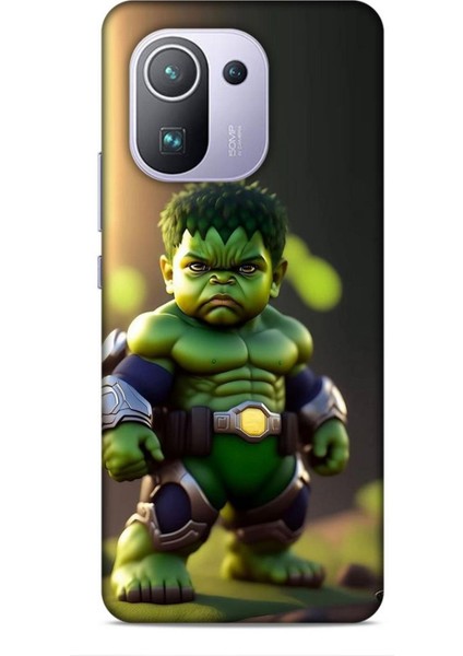 Xiaomi Mi 11 Pro Kılıf Caliburn 24 Hulk Bebek Darbe Emici Kılıf