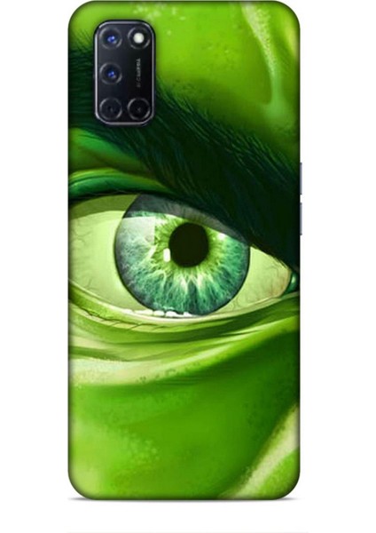 Oppo A52 Kılıf Caliburn 29 Hulk Göz Makro Leke Tutmaz Kapak