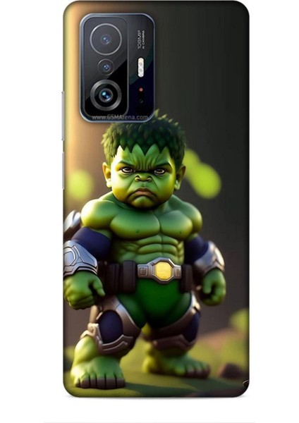 Xiaomi 11T Kılıf Caliburn 24 Hulk Bebek Darbe Emici Kılıf