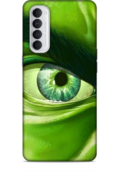 Oppo Reno 4 Pro Kılıf Caliburn 29 Hulk Göz Makro Leke Tutmaz Kapak