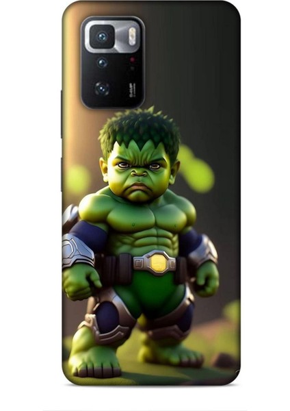 Xiaomi Poco X3 Gt Kılıf Caliburn 24 Hulk Bebek Darbe Emici Kılıf