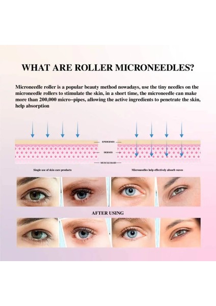 0,25 mm Stili 540 Derma Silindiri Saf Mikro Iğneleme Iğneleri Yüz Için Uzunluk Titanyum Dermoroller Mikroniddle Silindiri (Yurt Dışından) indirimleri