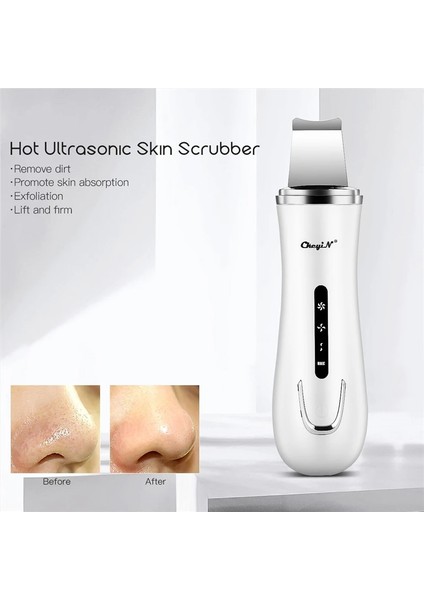 Siyah Stil Ultrasonik Iyon Cilt Scrubber Gözenek Temizleyici Siyah Nokta Remover Gental Peeling Peeling Kürek Cilt Sıkılaştırıcı Güzellik Enstrüman (Yurt Dışından) modelleri