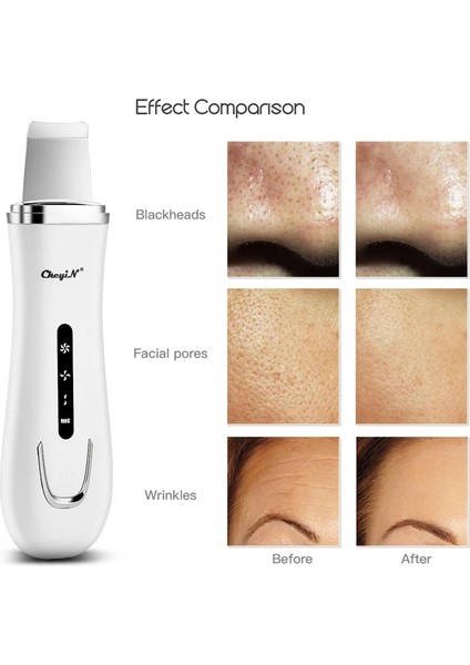Siyah Stil Ultrasonik Iyon Cilt Scrubber Gözenek Temizleyici Siyah Nokta Remover Gental Peeling Peeling Kürek Cilt Sıkılaştırıcı Güzellik Enstrüman (Yurt Dışından) fırsatları