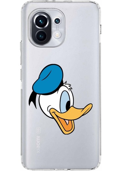 Xiaomi Mi 11 Kamera Korumalı Kapak Donald Duck Tasarımlı Şeffaf Kılıf
