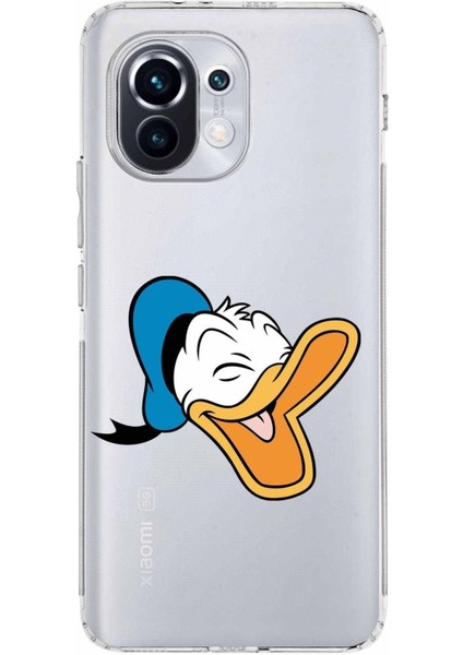 Xiaomi Mi 11 Kamera Korumalı Kapak Donald Duck Tasarımlı Şeffaf Kılıf
