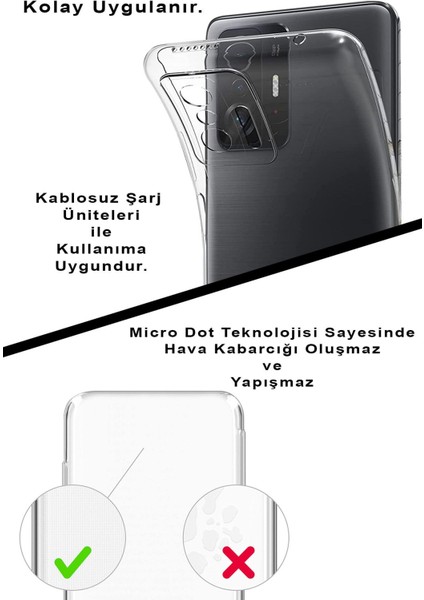 Xiaomi Mi Note 10 Lite Kamera Korumalı Kapak Semboller Tasarımlı Şeffaf Kılıf