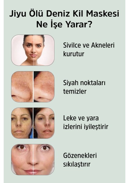 Doğal Siyah Nokta ve Akne Karşıtı Gözenek Sıkılaştırıcı Kil Maskesi 50 Ml.